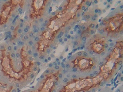 Immunohistochemistry (Formalin/PFA-fixed paraffin-embedded sections) - Anti-Meprin alpha antibody (AB232892)
