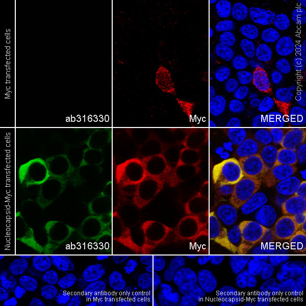 Immunocytochemistry/ Immunofluorescence - Anti-MERS-CoV Nucleocapsid protein antibody [abd208] - BSA and Azide free (AB316331), expandable thumbnail