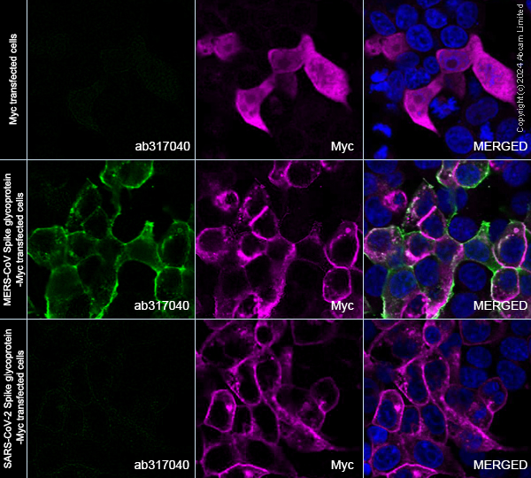 Immunocytochemistry/ Immunofluorescence - Anti-MERS-CoV Spike glycoprotein antibody [abd146] (AB317040), expandable thumbnail