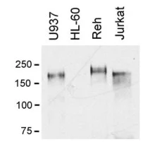 Western blot - Anti-MERTK antibody [A311F9G3] (AB52591)