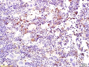 Immunohistochemistry (Formalin/PFA-fixed paraffin-embedded sections) - Anti-MERTK antibody (AB216564)