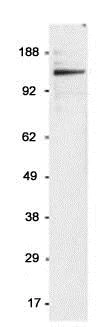 Western blot - Anti-MERTK antibody (AB70693)