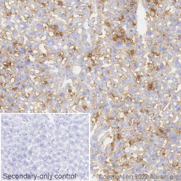 Immunohistochemistry (Frozen sections) - Anti-MERTK antibody [EPR17534-139] (AB184086)