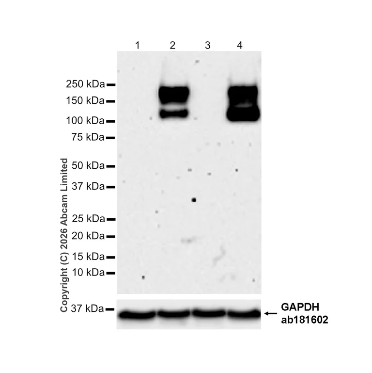 Western blot - Anti-MERTK antibody [EPR17534-139] (AB184086)