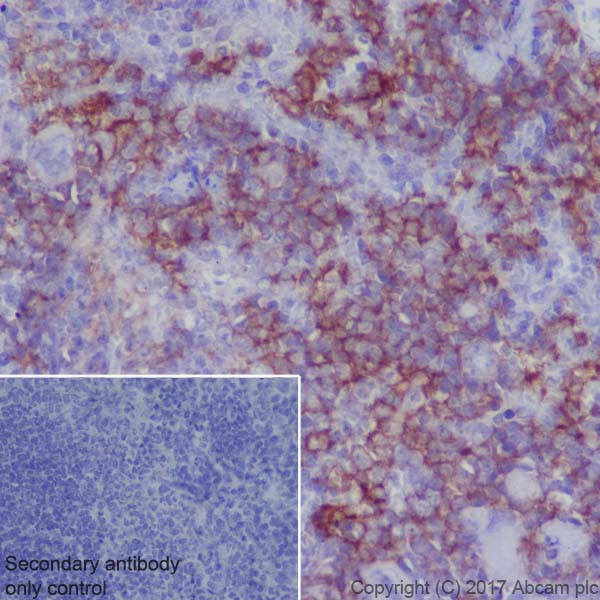 Immunohistochemistry (Formalin/PFA-fixed paraffin-embedded sections) - Anti-MERTK antibody [EPR17534-139] - BSA and Azide free (AB250715)