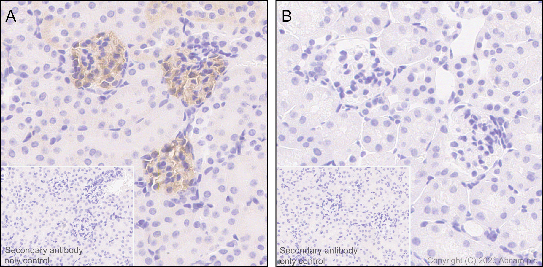 Immunohistochemistry (Formalin/PFA-fixed paraffin-embedded sections) - Anti-MERTK antibody [EPR17534-139] - BSA and Azide free (AB250715)