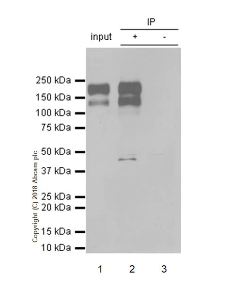 Immunoprecipitation - Anti-MERTK antibody [EPR17534-139] - BSA and Azide free (AB250715)
