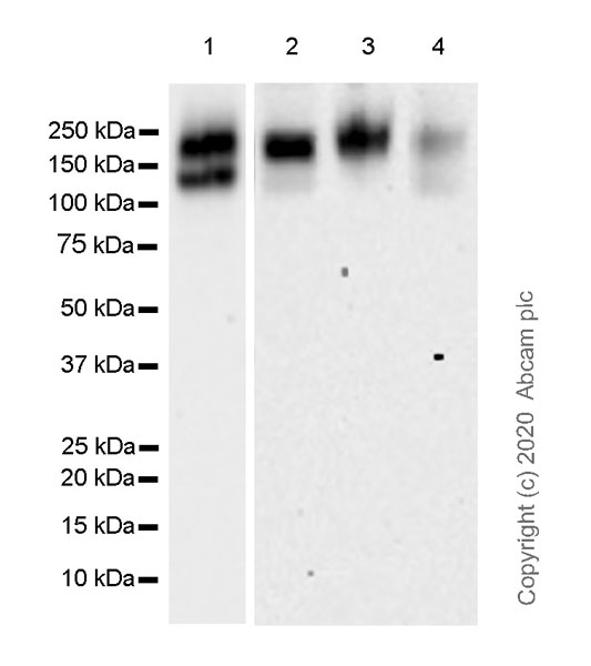 Western blot - Anti-MERTK antibody [EPR23248-259] (AB270448)