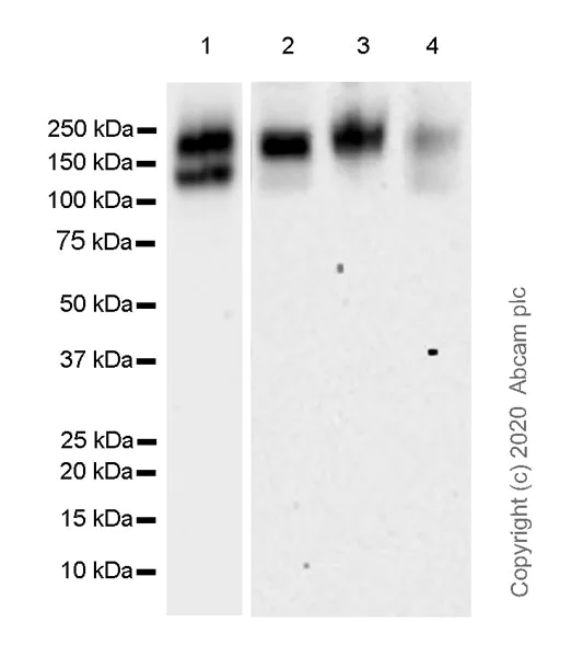 Western blot - Anti-MERTK antibody [EPR23248-259] (AB270448)
