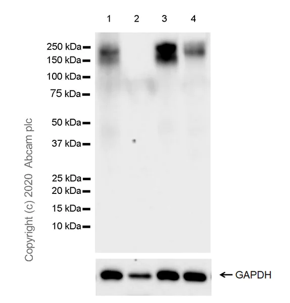 Western blot - Anti-MERTK antibody [EPR23248-259] (AB270448)