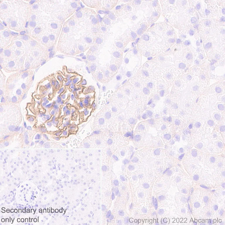 Western blot - Anti-MERTK antibody [EPR26359-12] (AB300136)