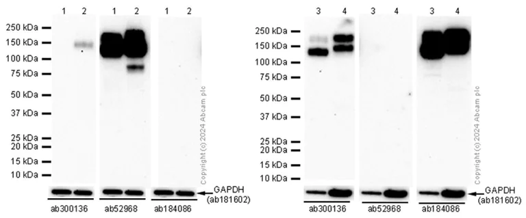 Western blot - Anti-MERTK antibody [EPR26359-12] (AB300136)