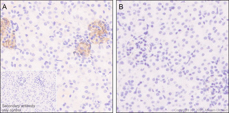 Immunohistochemistry (Formalin/PFA-fixed paraffin-embedded sections) - Anti-MERTK antibody [EPR26359-12] (BSA and Azide free) (AB300137)