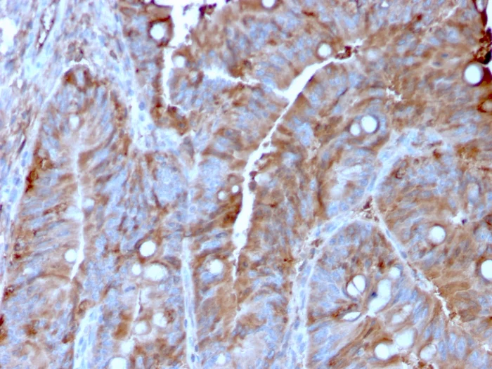 Immunohistochemistry (Formalin/PFA-fixed paraffin-embedded sections) - Anti-MERTK antibody [MERTK/3022] (AB268030)