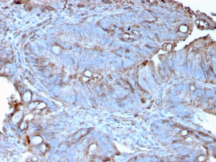 Immunohistochemistry (Formalin/PFA-fixed paraffin-embedded sections) - Anti-MERTK antibody [MERTK/3022] (AB268030)