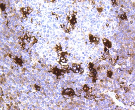 Immunohistochemistry (Formalin/PFA-fixed paraffin-embedded sections) - Anti-MERTK antibody [NO.H1B0] (AB238516)