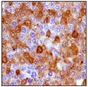 Immunohistochemistry (Formalin/PFA-fixed paraffin-embedded sections) - Anti-MERTK antibody [Y323] (ab52968), expandable thumbnail