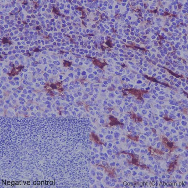 Immunohistochemistry (Formalin/PFA-fixed paraffin-embedded sections) - Anti-MERTK antibody [Y323] (AB52968), expandable thumbnail