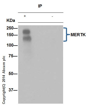 Immunoprecipitation - Anti-MERTK antibody [Y323] (AB52968), expandable thumbnail