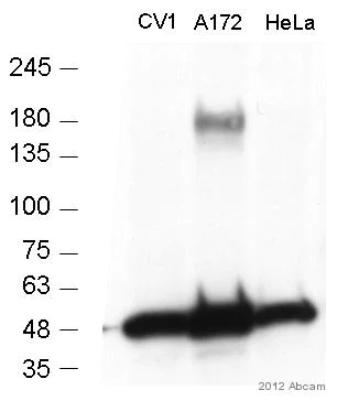 Western blot - Anti-MERTK antibody [Y323] (AB52968)