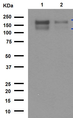 Western blot - Anti-MERTK antibody [Y323] (AB52968), expandable thumbnail