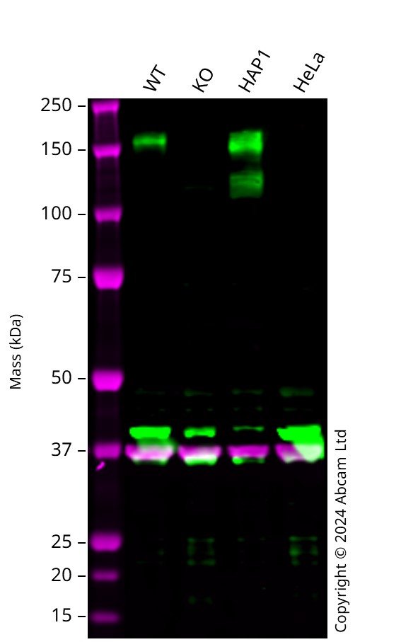 Western blot - Anti-MERTK antibody [Y323] (ab52968), expandable thumbnail
