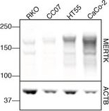 Western blot - Anti-MERTK antibody [Y323] (ab52968), expandable thumbnail