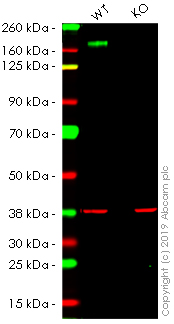 Western blot - Anti-MERTK antibody [Y323] (AB52968), expandable thumbnail