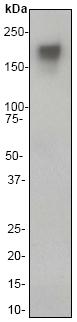 Western blot - Anti-MERTK antibody [Y323] (ab52968), expandable thumbnail