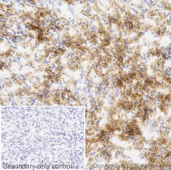 Immunohistochemistry (Frozen sections) - Anti-MERTK antibody [Y323] - BSA and Azide free (AB271851)