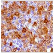 Immunohistochemistry (Formalin/PFA-fixed paraffin-embedded sections) - Anti-MERTK antibody [Y323] - Low endotoxin, Azide free (AB176887)