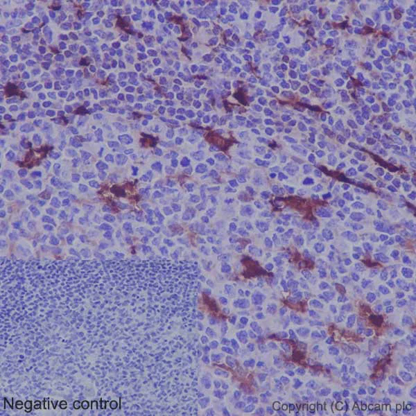 Immunohistochemistry (Formalin/PFA-fixed paraffin-embedded sections) - Anti-MERTK antibody [Y323] - Low endotoxin, Azide free (AB176887)