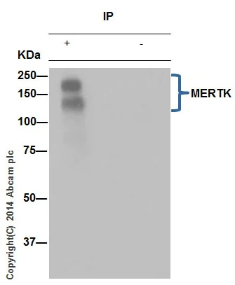 Immunoprecipitation - Anti-MERTK antibody [Y323] - Low endotoxin, Azide free (AB176887)