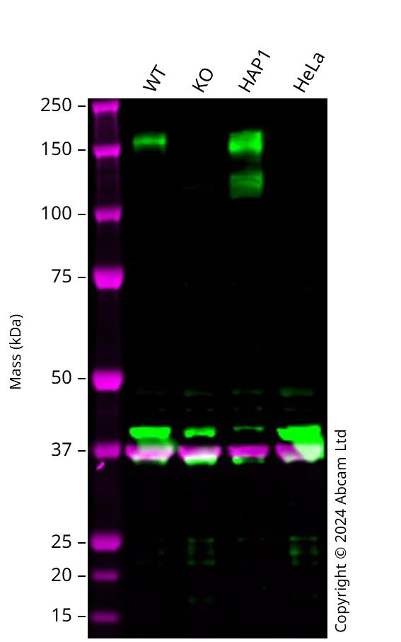 Western blot - Anti-MERTK antibody [Y323] - Low endotoxin, Azide free (AB176887)