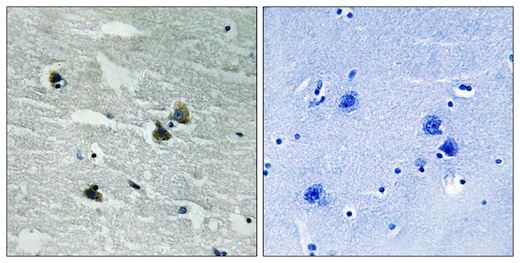 Immunohistochemistry (Formalin/PFA-fixed paraffin-embedded sections) - Anti-MERTK (phospho Y749) + TYRO3 (phospho Y681) antibody (AB192649)