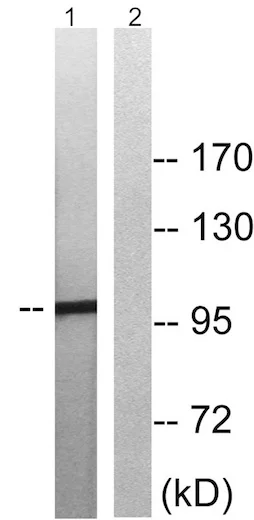 Western blot - Anti-MERTK (phospho Y749) + TYRO3 (phospho Y681) antibody (AB192649)