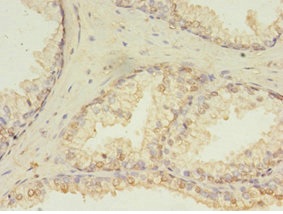 Immunohistochemistry (Formalin/PFA-fixed paraffin-embedded sections) - Anti-MESH1 antibody (AB235525)