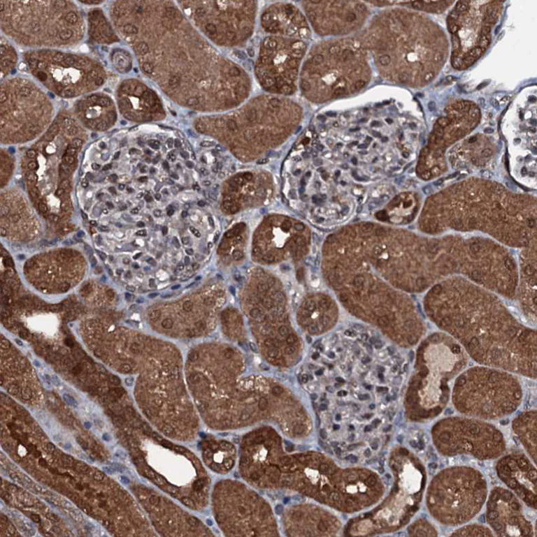 Immunohistochemistry (Formalin/PFA-fixed paraffin-embedded sections) - Anti-MESH1 antibody (AB243724)