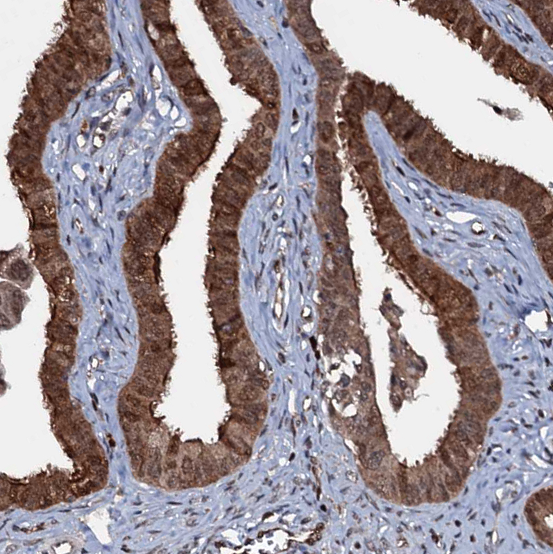 Immunohistochemistry (Formalin/PFA-fixed paraffin-embedded sections) - Anti-MESH1 antibody (AB243724)