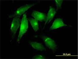 Immunocytochemistry/ Immunofluorescence - Anti-Mesothelin antibody (AB168740)