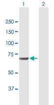 Western blot - Anti-Mesothelin antibody (AB168740)