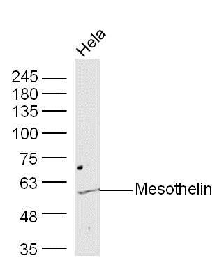 Western blot - Anti-Mesothelin antibody (AB215438), expandable thumbnail