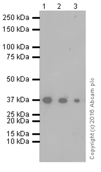 Western blot - Anti-Mesothelin antibody [EPR17823-52] (AB187063)