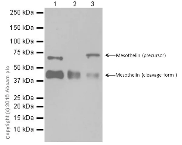 Western blot - Anti-Mesothelin antibody [EPR17823-52] (AB187063)