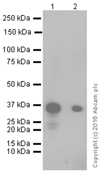 Western blot - Anti-Mesothelin antibody [EPR17823-69] (AB213174)