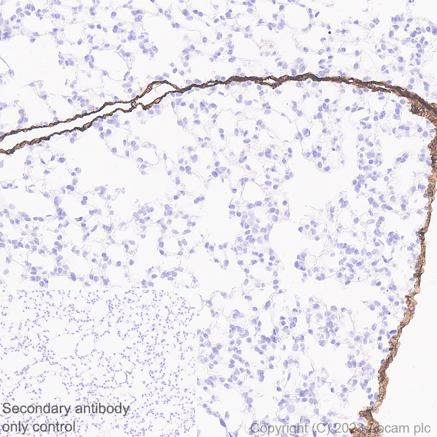 Immunohistochemistry (Formalin/PFA-fixed paraffin-embedded sections) - Anti-Mesothelin antibody [EPR17823-69] - BSA and Azide free (AB232219), expandable thumbnail