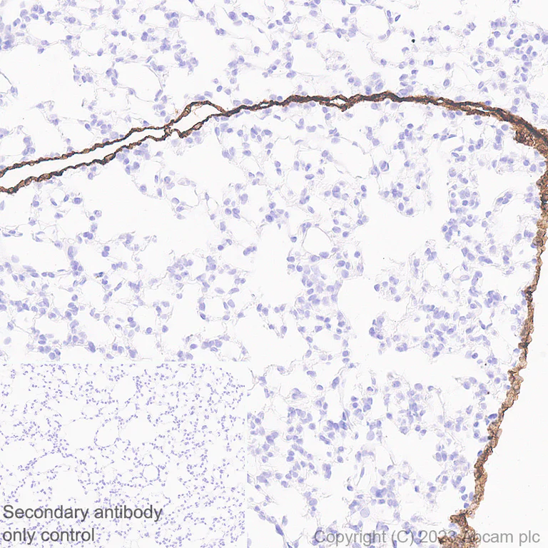 Immunohistochemistry (Formalin/PFA-fixed paraffin-embedded sections) - Anti-Mesothelin antibody [EPR17823-69] - BSA and Azide free (AB232219)