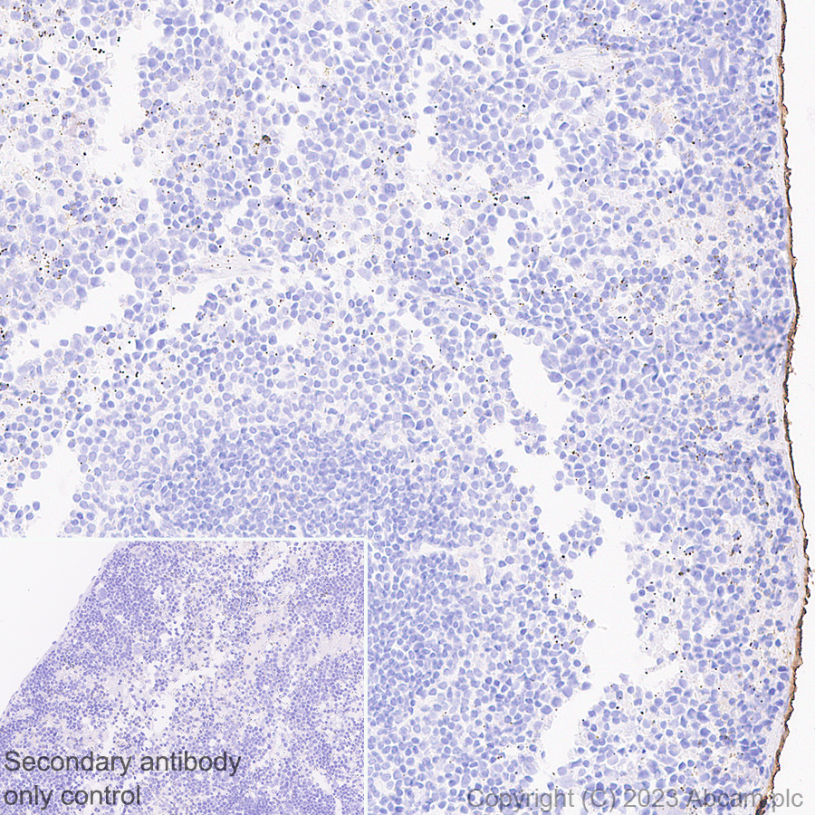 Immunohistochemistry (Formalin/PFA-fixed paraffin-embedded sections) - Anti-Mesothelin antibody [EPR17823-69] - BSA and Azide free (AB232219), expandable thumbnail