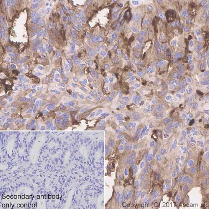 Immunohistochemistry (Formalin/PFA-fixed paraffin-embedded sections) - Anti-Mesothelin antibody [EPR19025-42] (ab196235), expandable thumbnail