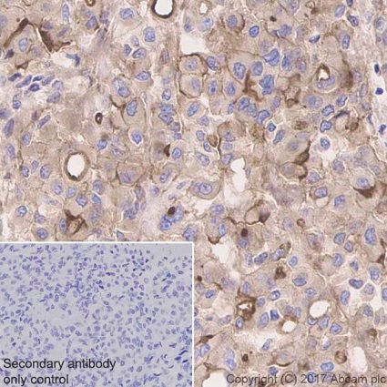 Immunohistochemistry (Formalin/PFA-fixed paraffin-embedded sections) - Anti-Mesothelin antibody [EPR19025-42] (AB196235), expandable thumbnail